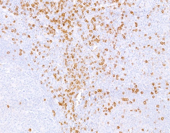 Mouse CD8 alpha Monoclonal Antibody