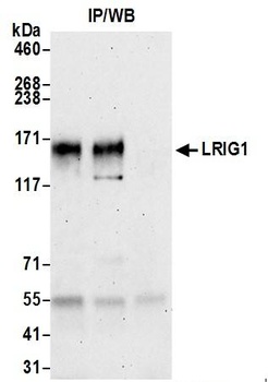Rabbit LRIG1 Antibody