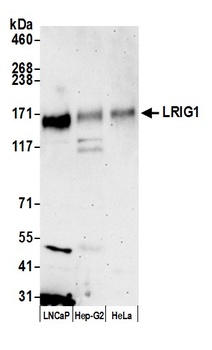 Rabbit LRIG1 Antibody
