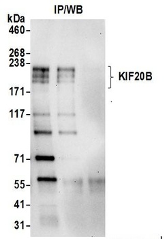Rabbit KIF20B Antibody