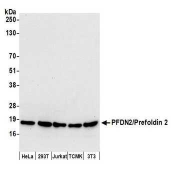 Rabbit PFDN2/Prefoldin 2 Antibody