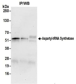 Rabbit Aspartyl-tRNA Synthetase/DARS Antibody