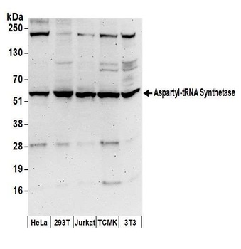 Rabbit Aspartyl-tRNA Synthetase/DARS Antibody