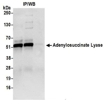 Rabbit Adenylosuccinate Lyase/ADSL Antibody