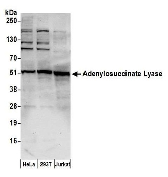 Rabbit Adenylosuccinate Lyase/ADSL Antibody
