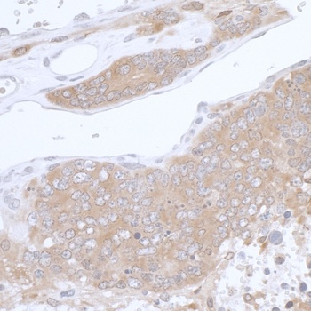 Rabbit PHGDH Antibody