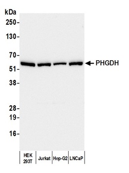 Rabbit PHGDH Antibody