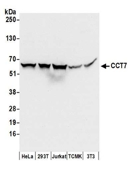 Rabbit CCT7 Antibody