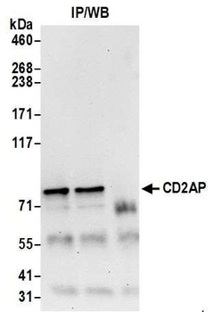 Rabbit CD2AP Antibody