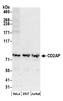 Rabbit CD2AP Antibody