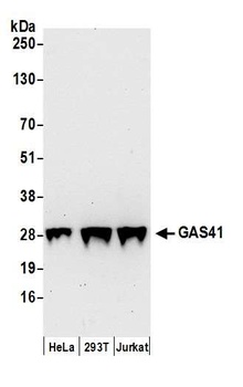 Rabbit GAS41 Antibody