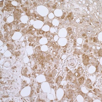 Rabbit HSP27 Antibody
