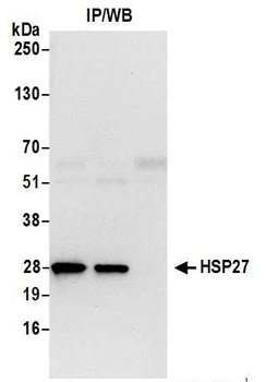 Rabbit HSP27 Antibody