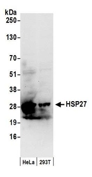 Rabbit HSP27 Antibody