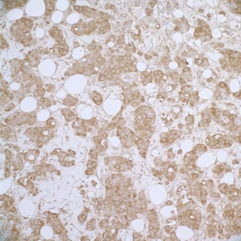 Rabbit HSP27 Antibody