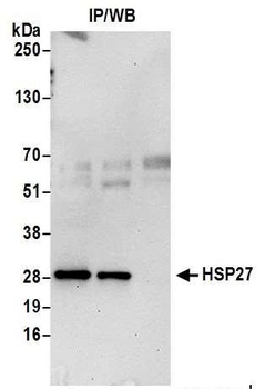 Rabbit HSP27 Antibody