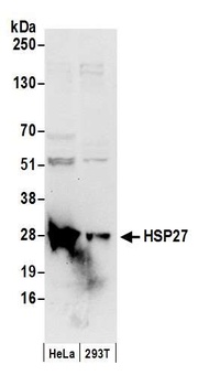 Rabbit HSP27 Antibody