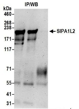 Rabbit SIPA1L2 Antibody