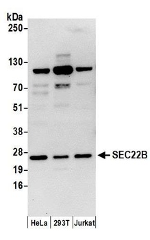 Rabbit SEC22B Antibody