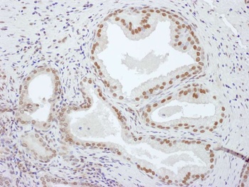 Rabbit PCYT1A Antibody