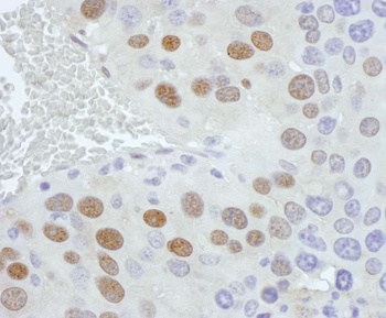 Rabbit PCYT1A Antibody