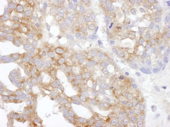 Rabbit IL14 Antibody