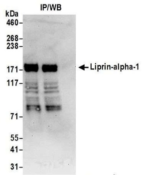 Rabbit Liprin-alpha-1 Antibody