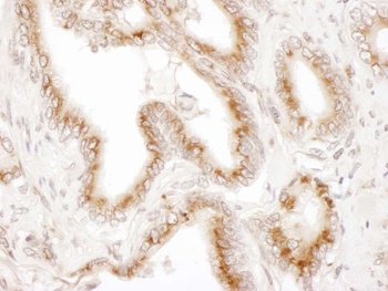 Rabbit TGOLN2 Antibody