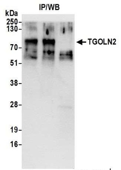 Rabbit TGOLN2 Antibody