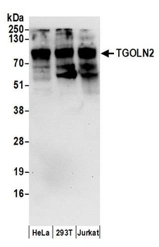 Rabbit TGOLN2 Antibody