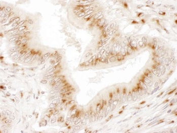Rabbit TGOLN2 Antibody