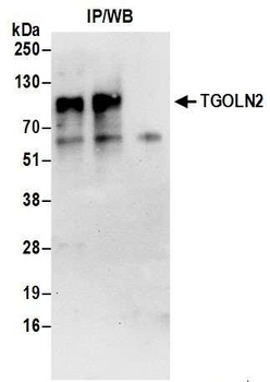 Rabbit TGOLN2 Antibody