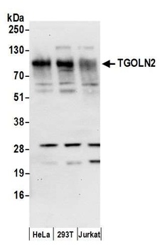 Rabbit TGOLN2 Antibody