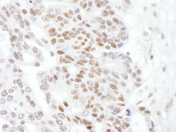 Rabbit RNA Polymerase II, Phospho (S2) Antibody
