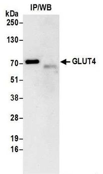 Rabbit GLUT4 Antibody