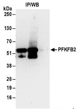 Rabbit PFKFB2 Antibody