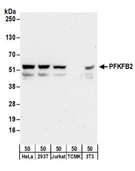 Rabbit PFKFB2 Antibody