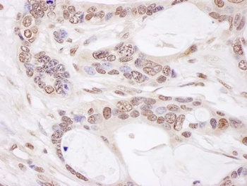 Rabbit CHAMP1 Antibody