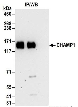 Rabbit CHAMP1 Antibody