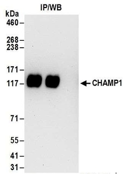 Rabbit CHAMP1 Antibody