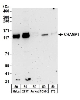 Rabbit CHAMP1 Antibody