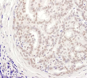 Rabbit MEPCE Antibody