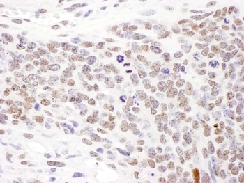 Rabbit Phospho SMC1 (S957) Antibody