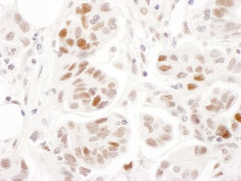 Rabbit Phospho SMC1 (S957) Antibody