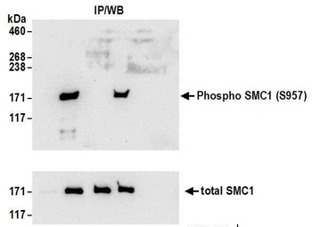 Rabbit Phospho SMC1 (S957) Antibody