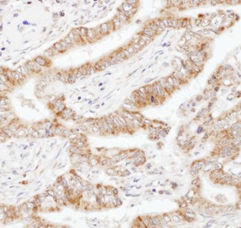 Rabbit UBAC1 Antibody