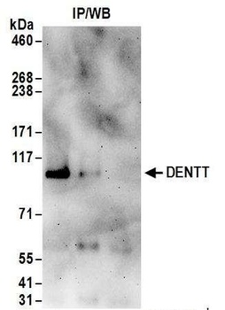 Rabbit DENTT Antibody