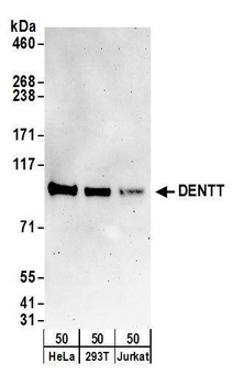 Rabbit DENTT Antibody