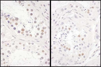 Rabbit DENTT Antibody
