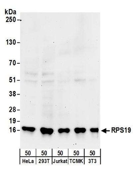 Rabbit RPS19 Antibody